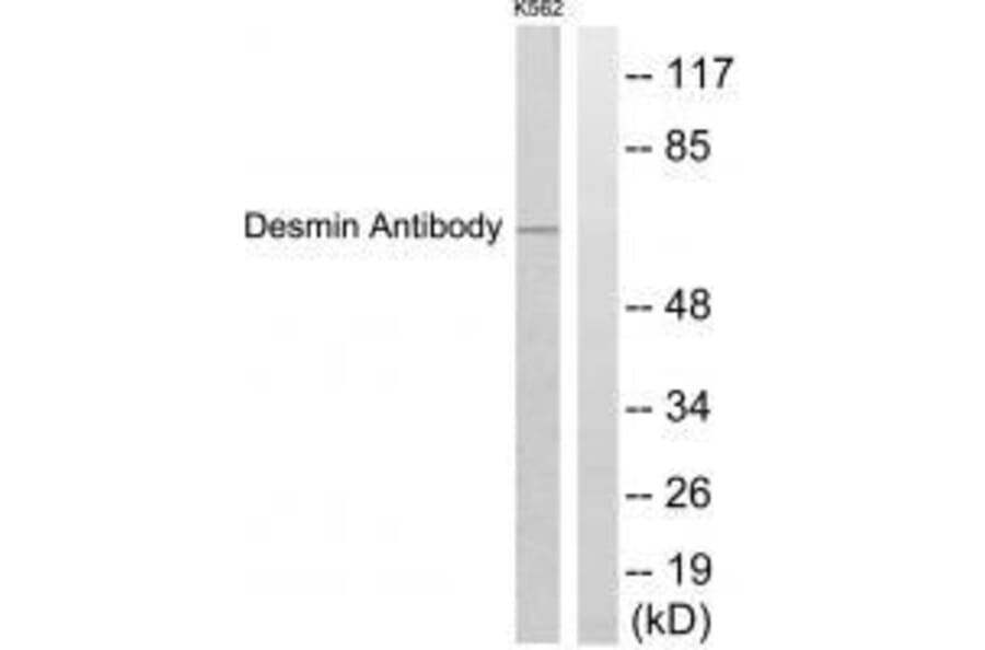 Western blot - Desmin Antibody from Signalway Antibody (33355) - Antibodies.com