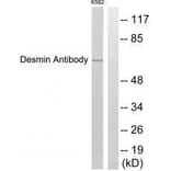 Western blot - Desmin Antibody from Signalway Antibody (33355) - Antibodies.com