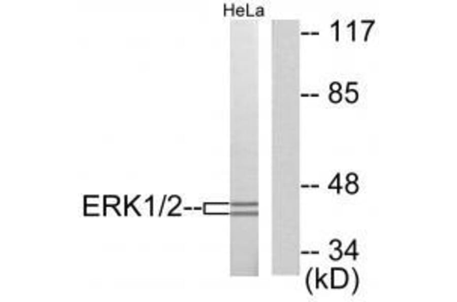 Western blot - ERK1/2 Antibody from Signalway Antibody (33367) - Antibodies.com