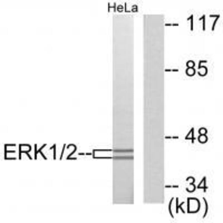 Western blot - ERK1/2 Antibody from Signalway Antibody (33367) - Antibodies.com