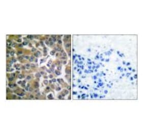 Immunohistochemistry - FAP-1 Antibody from Signalway Antibody (33369) - Antibodies.com