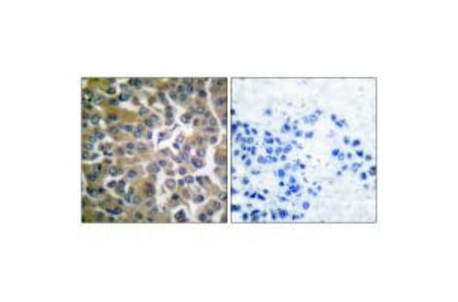 Immunohistochemistry - FAP-1 Antibody from Signalway Antibody (33369) - Antibodies.com