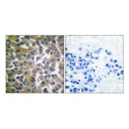 Immunohistochemistry - FAP-1 Antibody from Signalway Antibody (33369) - Antibodies.com