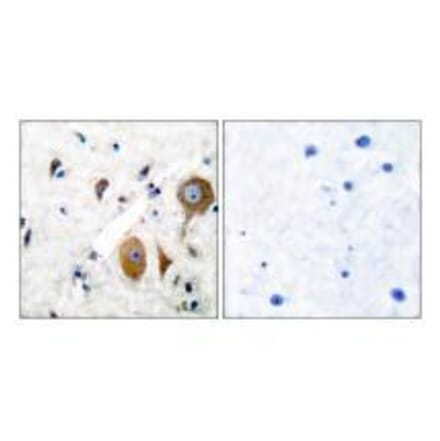 Immunohistochemistry - GluR8 Antibody from Signalway Antibody (33391) - Antibodies.com