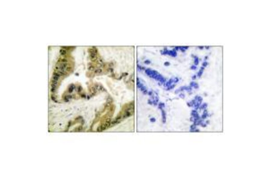 Immunohistochemistry - HDAC10 Antibody from Signalway Antibody (33399) - Antibodies.com
