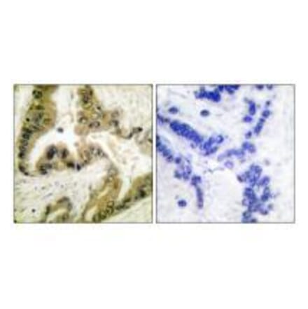 Immunohistochemistry - HDAC10 Antibody from Signalway Antibody (33399) - Antibodies.com