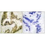 Immunohistochemistry - HDAC10 Antibody from Signalway Antibody (33399) - Antibodies.com