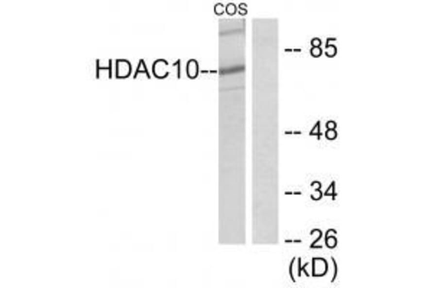 Western blot - HDAC10 Antibody from Signalway Antibody (33399) - Antibodies.com