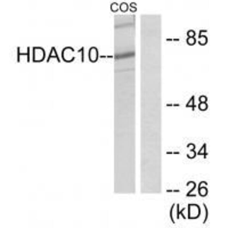 Western blot - HDAC10 Antibody from Signalway Antibody (33399) - Antibodies.com