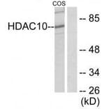 Western blot - HDAC10 Antibody from Signalway Antibody (33399) - Antibodies.com
