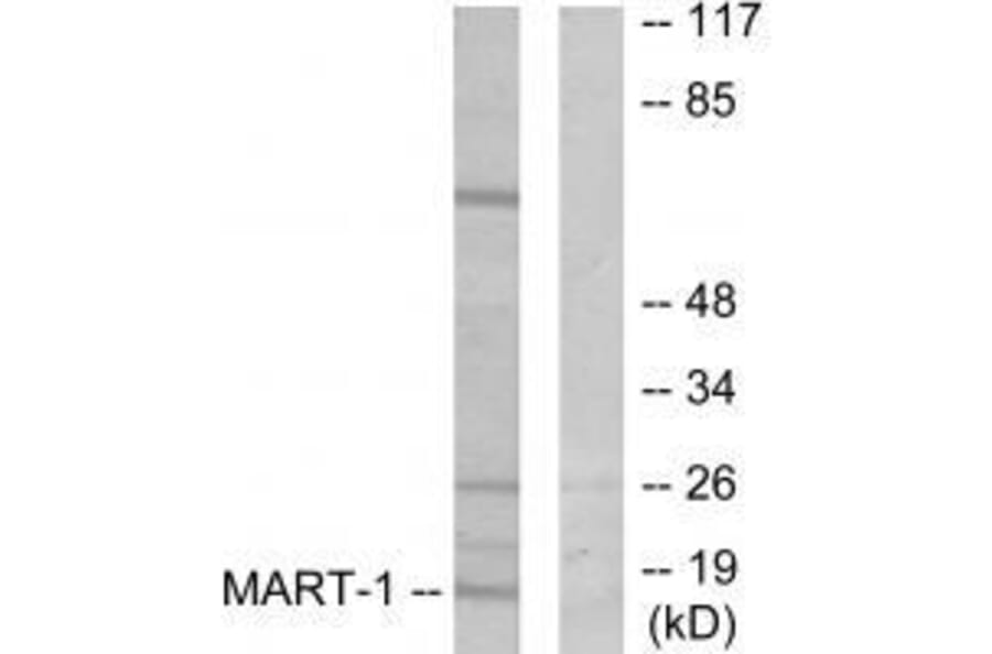 Western blot - MART-1 Antibody from Signalway Antibody (33429) - Antibodies.com