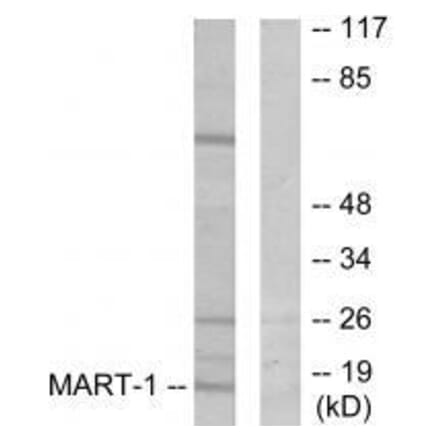 Western blot - MART-1 Antibody from Signalway Antibody (33429) - Antibodies.com