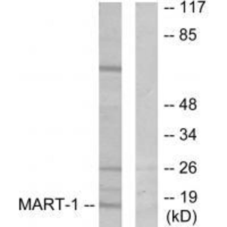 Western blot - MART-1 Antibody from Signalway Antibody (33429) - Antibodies.com