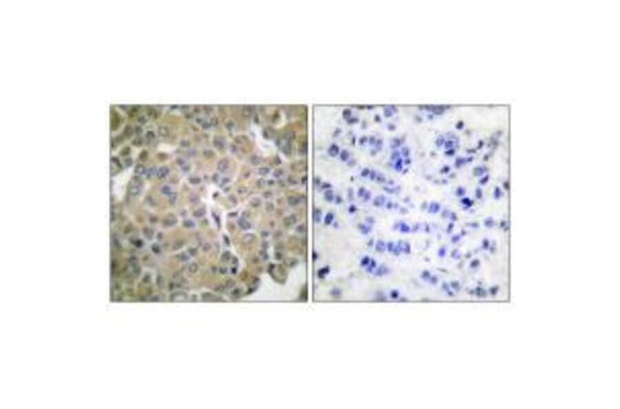 Immunohistochemistry - MART-1 Antibody from Signalway Antibody (33429) - Antibodies.com
