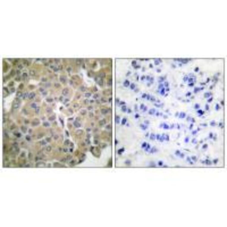 Immunohistochemistry - MART-1 Antibody from Signalway Antibody (33429) - Antibodies.com