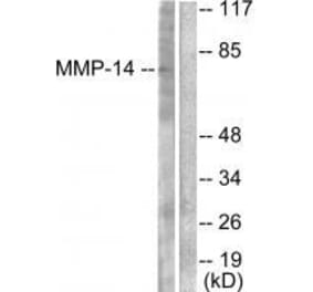 Western blot - MMP-14 Antibody from Signalway Antibody (33437) - Antibodies.com