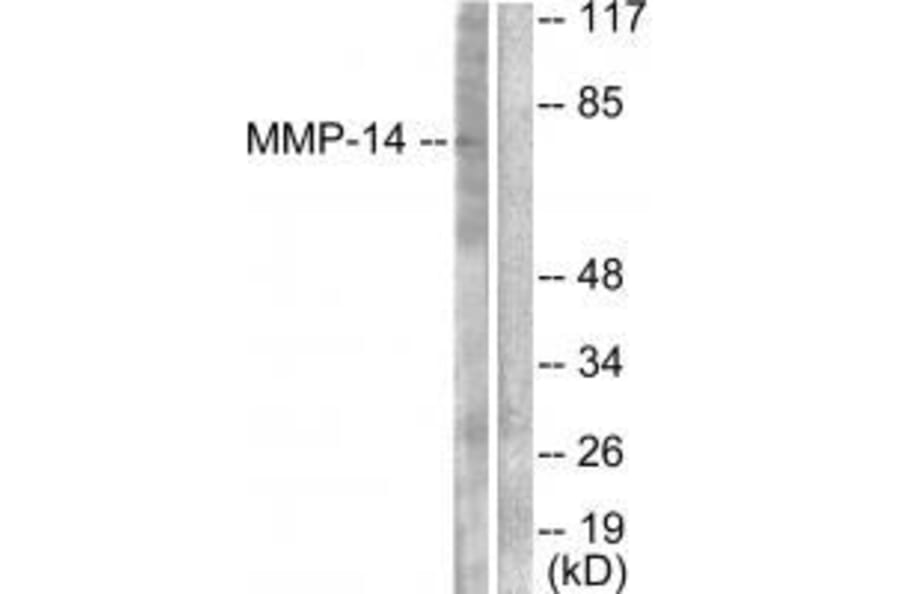 Western blot - MMP-14 Antibody from Signalway Antibody (33437) - Antibodies.com