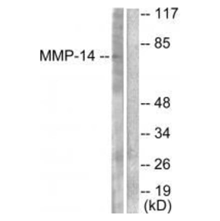 Western blot - MMP-14 Antibody from Signalway Antibody (33437) - Antibodies.com