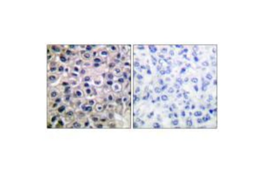 Immunohistochemistry - MMP-14 Antibody from Signalway Antibody (33437) - Antibodies.com