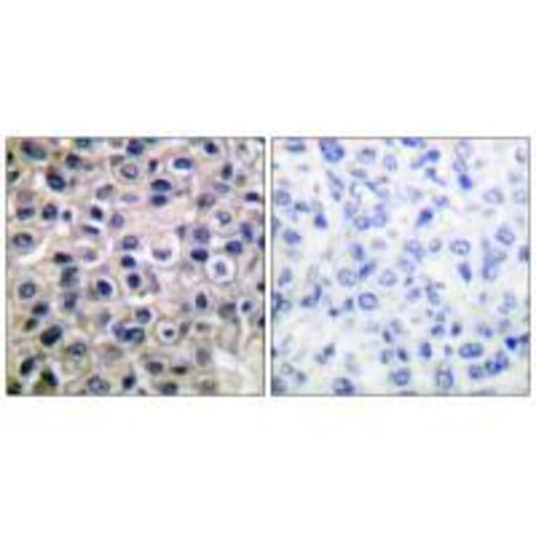 Immunohistochemistry - MMP-14 Antibody from Signalway Antibody (33437) - Antibodies.com