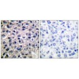 Immunohistochemistry - MMP-14 Antibody from Signalway Antibody (33437) - Antibodies.com