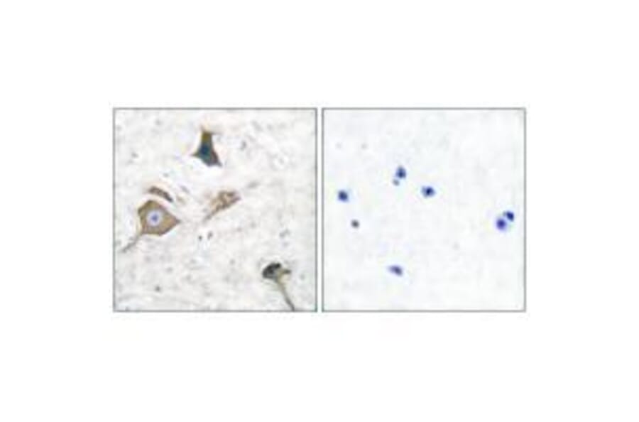 Immunohistochemistry - MMP-16 Antibody from Signalway Antibody (33439) - Antibodies.com