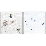 Immunohistochemistry - MMP-16 Antibody from Signalway Antibody (33439) - Antibodies.com