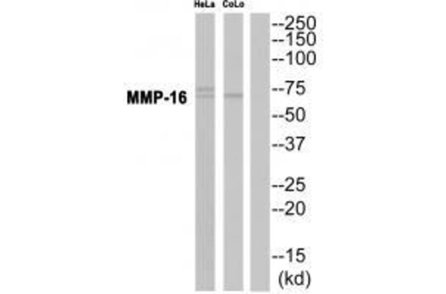 Western blot - MMP-16 Antibody from Signalway Antibody (33439) - Antibodies.com