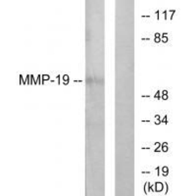 Western blot - MMP-19 Antibody from Signalway Antibody (33440) - Antibodies.com