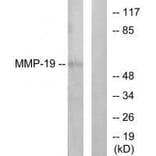 Western blot - MMP-19 Antibody from Signalway Antibody (33440) - Antibodies.com