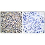 Immunohistochemistry - MMP-19 Antibody from Signalway Antibody (33440) - Antibodies.com