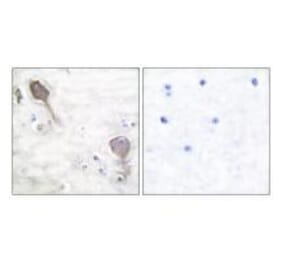 Immunohistochemistry - Parkin Antibody from Signalway Antibody (33464) - Antibodies.com