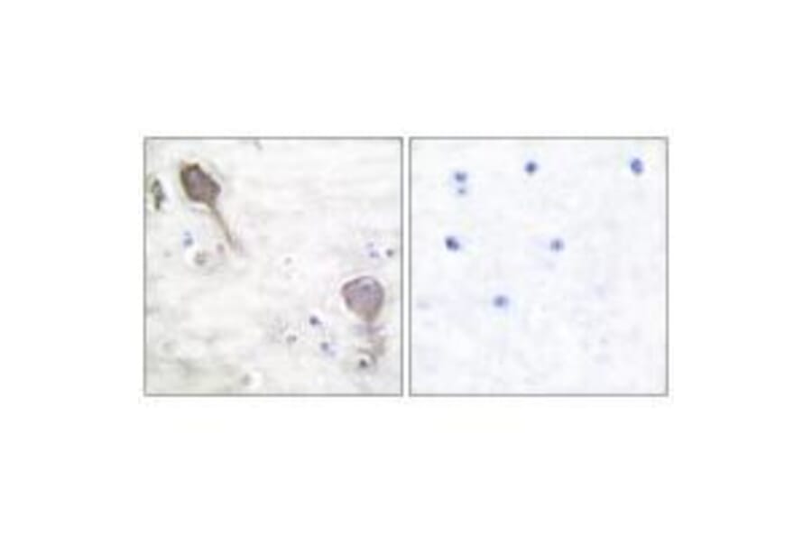 Immunohistochemistry - Parkin Antibody from Signalway Antibody (33464) - Antibodies.com