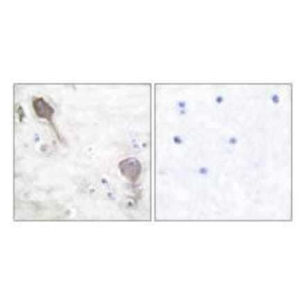 Immunohistochemistry - Parkin Antibody from Signalway Antibody (33464) - Antibodies.com