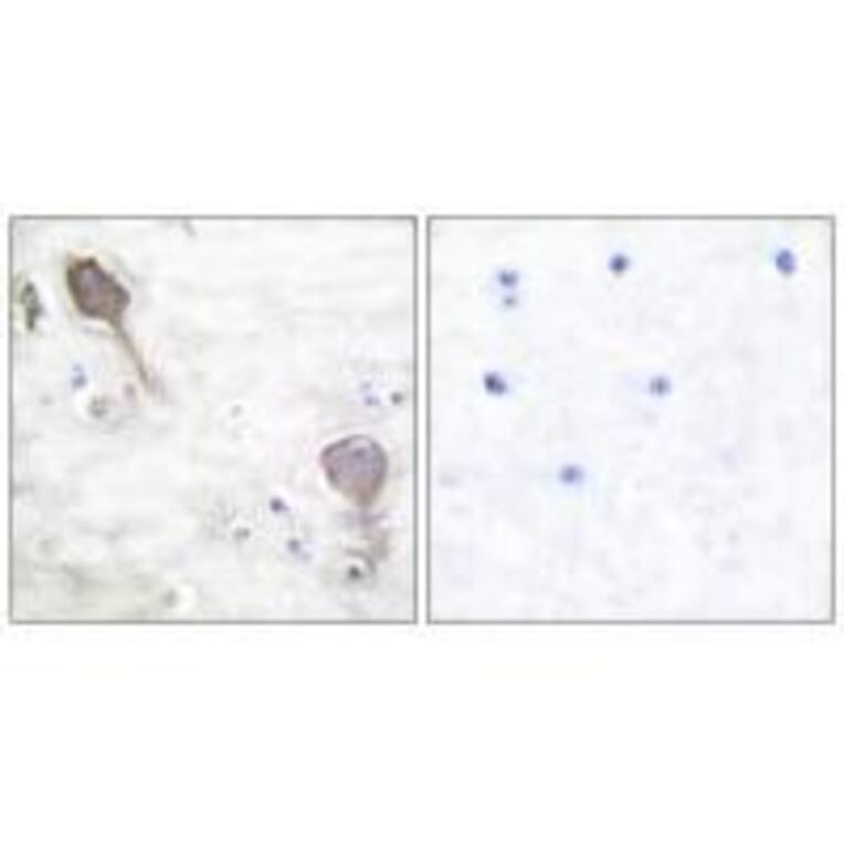 Immunohistochemistry - Parkin Antibody from Signalway Antibody (33464) - Antibodies.com