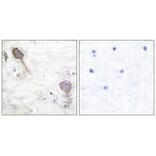 Immunohistochemistry - Parkin Antibody from Signalway Antibody (33464) - Antibodies.com