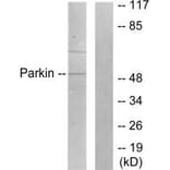 Western blot - Parkin Antibody from Signalway Antibody (33464) - Antibodies.com