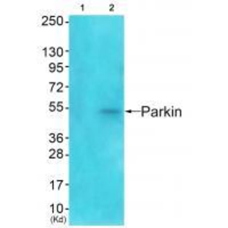 Western blot - Parkin Antibody from Signalway Antibody (33464) - Antibodies.com