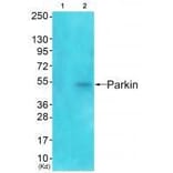 Western blot - Parkin Antibody from Signalway Antibody (33464) - Antibodies.com