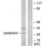 Western blot - PGP9.5 Antibody from Signalway Antibody (33472) - Antibodies.com