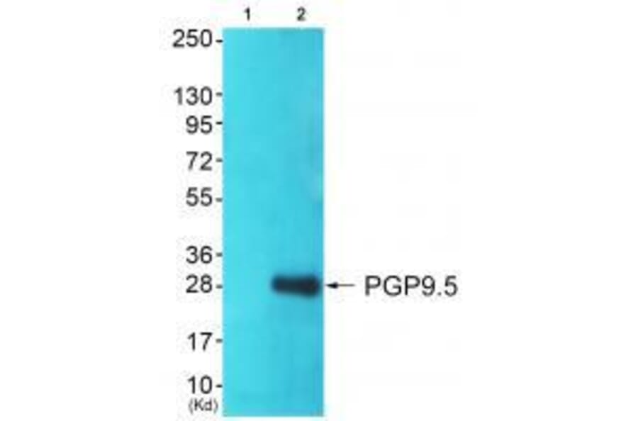 Western blot - PGP9.5 Antibody from Signalway Antibody (33472) - Antibodies.com