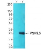 Western blot - PGP9.5 Antibody from Signalway Antibody (33472) - Antibodies.com