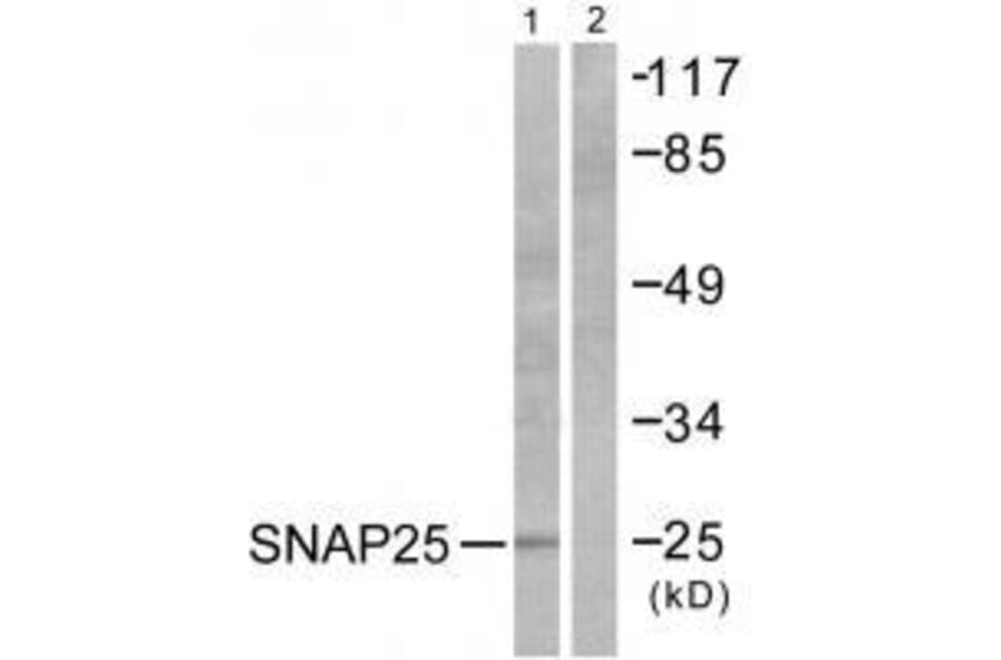 Western blot - SNAP25 Antibody from Signalway Antibody (33487) - Antibodies.com
