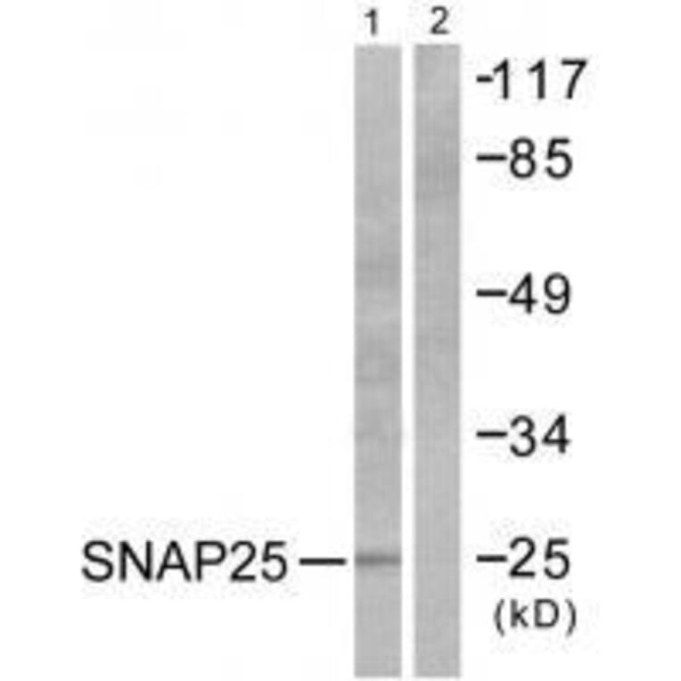 Western blot - SNAP25 Antibody from Signalway Antibody (33487) - Antibodies.com