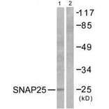 Western blot - SNAP25 Antibody from Signalway Antibody (33487) - Antibodies.com