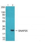 Western blot - SNAP25 Antibody from Signalway Antibody (33487) - Antibodies.com
