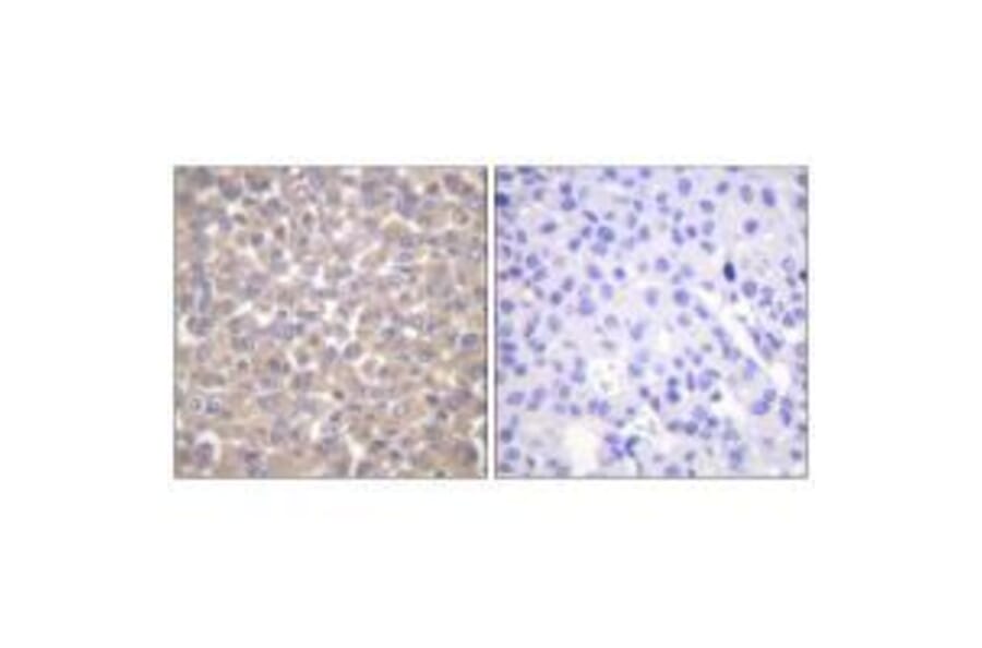 Immunohistochemistry - TRADD Antibody from Signalway Antibody (33529) - Antibodies.com