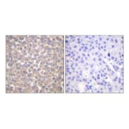 Immunohistochemistry - TRADD Antibody from Signalway Antibody (33529) - Antibodies.com