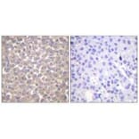 Immunohistochemistry - TRADD Antibody from Signalway Antibody (33529) - Antibodies.com