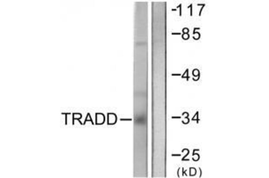 Western blot - TRADD Antibody from Signalway Antibody (33529) - Antibodies.com